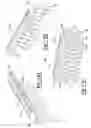Fig. 18 - Porous bidirectional bellowed tracheal reconstruction device