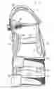 Fig. 01 - Low profile knee brace and method of using same