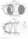 Fig. 09 - Ankle-foot orthosis