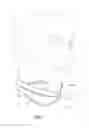 Fig. 02 - CERVICAL SPLINTS AND METHODS FOR MAKING THE SAME