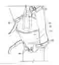 Fig. 01 - Catheter collection and drainage device and system