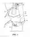 Fig. 02 - Catheter collection and drainage device and system