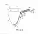 Fig. 03 - Catheter collection and drainage device and system