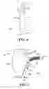 Fig. 07 - Catheter collection and drainage device and system