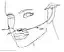 Fig. 01 - SLEEP APNEA DEVICE TO POSITIVELY BLOCK EXHALING AND METHOD OF USE