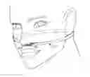Fig. 01 - Sleep apnea device to positively block exhaling and method of use