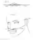 Fig. 06 - Sleep apnea device to positively block exhaling and method of use