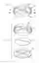 Fig. 07 - Sleep apnea device to positively block exhaling and method of use