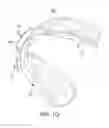 Fig. 05 - ORAL APPLIANCE
