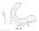 Fig. 06 - ORAL APPLIANCE