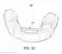 Fig. 16 - ORAL APPLIANCE