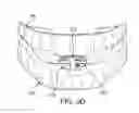 Fig. 17 - ORAL APPLIANCE