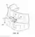 Fig. 18 - ORAL APPLIANCE