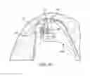 Fig. 19 - ORAL APPLIANCE