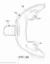 Fig. 20 - ORAL APPLIANCE