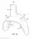 Fig. 21 - ORAL APPLIANCE