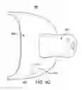 Fig. 22 - ORAL APPLIANCE