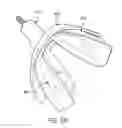 Fig. 24 - ORAL APPLIANCE