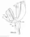Fig. 25 - ORAL APPLIANCE