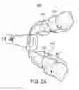Fig. 27 - ORAL APPLIANCE