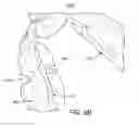 Fig. 28 - ORAL APPLIANCE