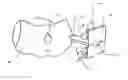 Fig. 01 - Female condom with adhering shield and method of manufacture