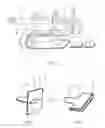 Fig. 04 - Female condom with adhering shield and method of manufacture