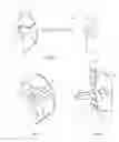 Fig. 06 - Female condom with adhering shield and method of manufacture