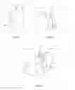 Fig. 10 - Female condom with adhering shield and method of manufacture