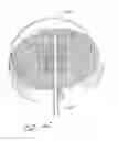 Fig. 05 - Minimally invasive glaucoma surgical instrument and method