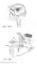 Fig. 08 - Minimally invasive glaucoma surgical instrument and method