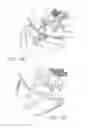Fig. 10 - Minimally invasive glaucoma surgical instrument and method