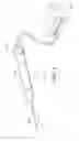 Fig. 17 - Minimally invasive glaucoma surgical instrument and method
