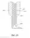 Fig. 24 - Minimally invasive glaucoma surgical instrument and method