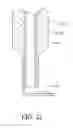 Fig. 25 - Minimally invasive glaucoma surgical instrument and method