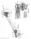 Fig. 11 - Release handle mechanisms for a spar of a limb holder