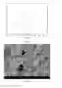 Fig. 02 - Hollow calcium phosphate particles