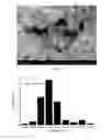 Fig. 03 - Hollow calcium phosphate particles
