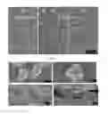 Fig. 07 - Hollow calcium phosphate particles