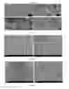 Fig. 08 - Hollow calcium phosphate particles