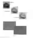 Fig. 14 - Hollow calcium phosphate particles