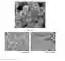 Fig. 18 - Hollow calcium phosphate particles