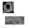Fig. 19 - Hollow calcium phosphate particles