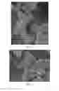 Fig. 20 - Hollow calcium phosphate particles