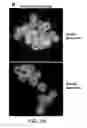 Fig. 13 - Multistage delivery of active agents