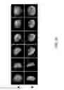 Fig. 52 - Multistage delivery of active agents