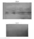 Fig. 05 - Transdermal delivery system comprising donepezil or its salt