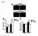 Fig. 04 - NOVEL USE OF PINOSYLVIN FOR ANGIOGENESIS PROMOTION