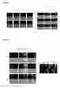 Fig. 11 - Compositions and methods for treating cancer