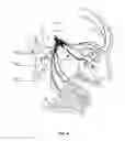 Fig. 05 - Method of treating disease by auricular anesthesia of cranial nerves